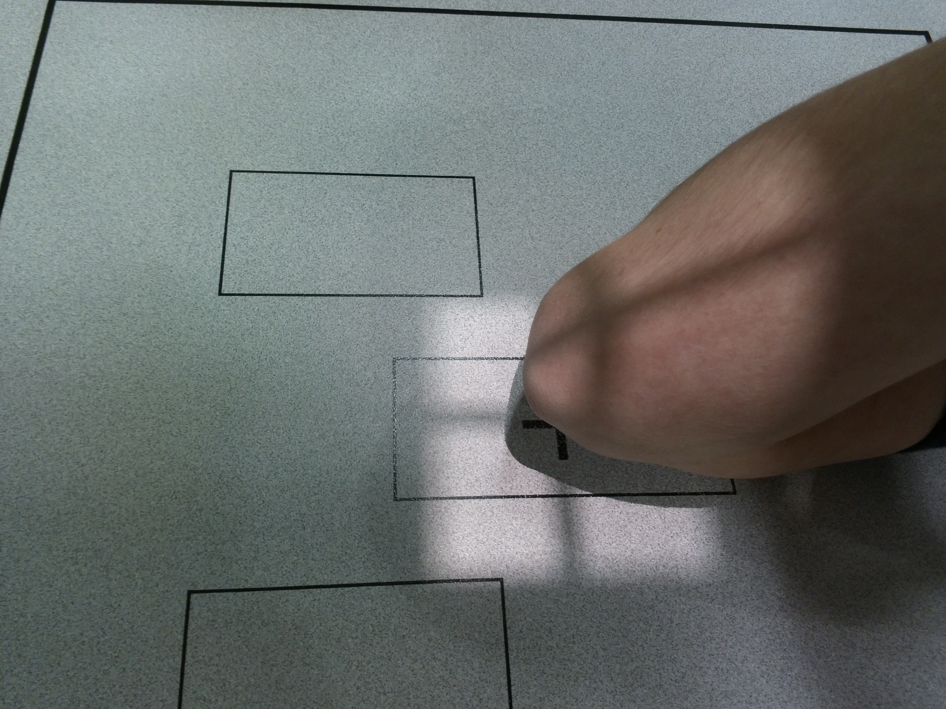 Radiografía AP Flexión Aguda